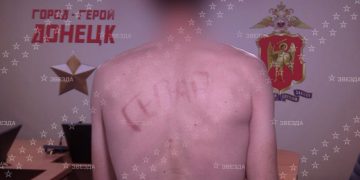 Выжженное клеймо на спине: житель ДНР пострадал от пыток боевиков ВСУ Выжженное клеймо на спине: житель ДНР пострадал от пыток боевиков ВСУ