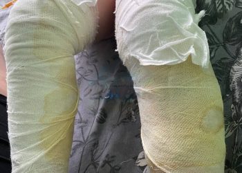 В донецком автобусе 5-летний мальчик получил ожоги ног