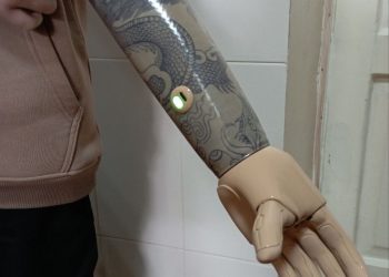 Девять детей из ЛНР получили бионические протезы