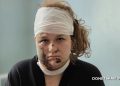 «Меня после взрыва придавило плитой, а дальше я почти ничего не помню»: Студентка колледжа Старобельска рассказала о пережитом