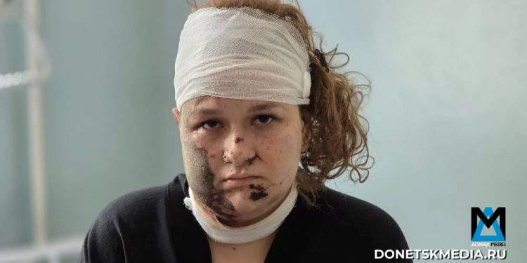 «Меня после взрыва придавило плитой, а дальше я почти ничего не помню»: Студентка колледжа Старобельска рассказала о пережитом
