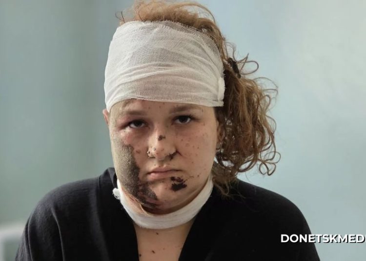 «Меня после взрыва придавило плитой, а дальше я почти ничего не помню»: Студентка колледжа Старобельска рассказала о пережитом