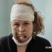 «Меня после взрыва придавило плитой, а дальше я почти ничего не помню»: Студентка колледжа Старобельска рассказала о пережитом