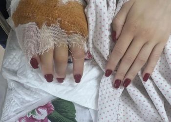 После сложнейшей операции в ЛНР раненую девушку экстренно эвакуировали в Москву