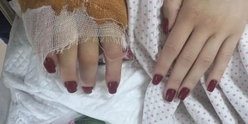 После сложнейшей операции в ЛНР раненую девушку экстренно эвакуировали в Москву